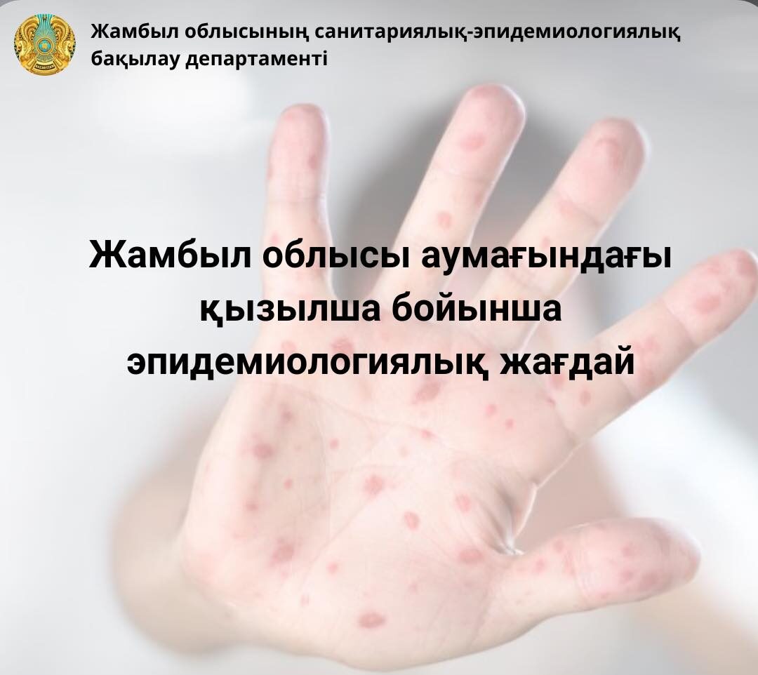 Жамбыл облысы аумағындағы қызылша бойынша эпидемиологиялық жағдай